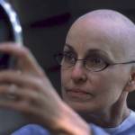 A part of getting chemotherapy is losing your hair. Nellie chose to show her bald head. Contributed photo.