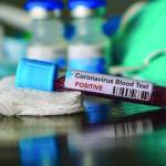 Second case of COVID-19 reported in Kitsap, linked to first case