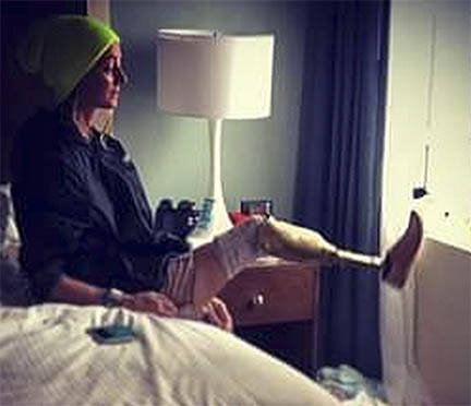 Putting on her prosthetic just to do the smallest things still can bother her, she says.