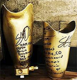 Sarah Dean has saved some of her old prosthetics.