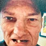 Fairy Tale Dental patient before his dental procedure. Photo courtesy of Fairy Tale Dental.